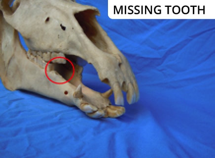 missing-tooth